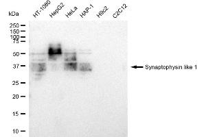 Western blotting analysis using Synaptophysin like 1 antibody (ABIN7800486). (Recombinant SYPL1 antibody)