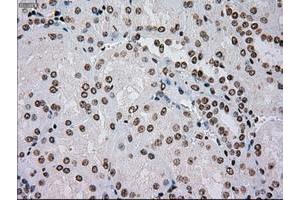 Image no. 15 for anti-TYRO3 Protein Tyrosine Kinase (TYRO3) antibody (ABIN1501607)