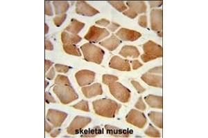 Formalin-fixed and paraffin-embedded human skeletal muscle reacted with PD2 Antibody (Center), which was peroxidase-conjugated to the secondary antibody, followed by DAB staining. (AMPD2 antibody  (AA 187-217))