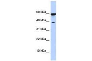 Image no. 1 for anti-Protein Phosphatase 1, Regulatory Subunit 8 (PPP1R8) (AA 215-264) antibody (ABIN6740668) (PPP1R8 antibody  (AA 215-264))