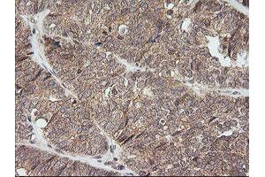 Image no. 2 for anti-NFKB Inhibitor Interacting Ras-Like 1 (NKIRAS1) antibody (ABIN1499742) (NKIRAS1 antibody)
