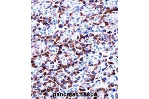 Immunohistochemistry (IHC) image for anti-Coiled-Coil Domain Containing 50 (CCDC50) antibody (ABIN2997838) (CCDC50 antibody)