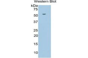 WB of Protein Standard: different control antibodies against Highly purified E. (Glucocorticoid Receptor ELISA Kit)