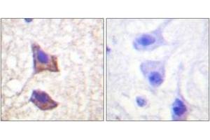 Immunohistochemistry analysis of paraffin-embedded human brain tissue, using CD130/gp130 (Ab-782) Antibody. (CD130/gp130 antibody  (AA 748-797))