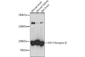 Western blot analysis of extracts of various cell lines, using IGF1R antibody (ABIN7267899) at 1:1000 dilution. (IGF1R antibody  (AA 741-935))