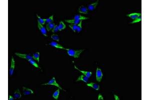 Immunofluorescence (IF) image for anti-LIM and SH3 Protein 1 (LASP1) (AA 128-252) antibody (ABIN7158350)
