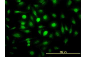 Immunofluorescence of monoclonal antibody to ZWINT on HeLa cell. (ZWINT antibody  (AA 1-277))