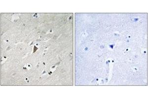 Immunohistochemistry analysis of paraffin-embedded human brain, using PDK1 (Phospho-Tyr9) Antibody. (PDPK1 antibody  (pTyr9))