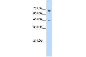 WB Suggested Anti-KLHL25 Antibody Titration:  0. (KLHL25 antibody  (N-Term))
