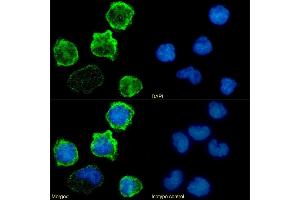 Immunofluorescence staining of fixed Jurkat cells with anti-CD18 antibody 60. (Recombinant Integrin beta 2 antibody)