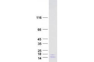 Validation with Western Blot