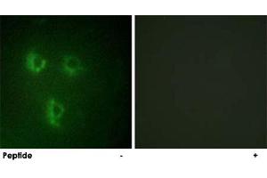 Immunofluorescence analysis of HUVEC cells, using PMEPA1 polyclonal antibody .