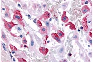 Human Uterus, Pregnant (formalin-fixed, paraffin-embedded) stained with BRS3 antibody ABIN213491 at 10 ug/ml followed by biotinylated goat anti-rabbit IgG secondary antibody ABIN481713, alkaline phosphatase-streptavidin and chromogen. (BRS3 antibody  (Cytoplasmic Domain))