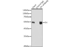 Immunoprecipitation analysis of 600 μg extracts of Mouse brain using 3 μg Src antibody (ABIN7269727).