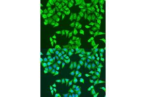Immunofluorescence analysis of U2OS cells using RhoA antibody (ABIN7269865) at dilution of 1:100. (RHOA antibody  (AA 1-193))