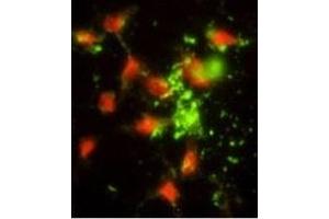 Immunofluorescence analysis of SRP72 Antibody (Center) with hela cells. (SRP72 antibody  (AA 119-148))