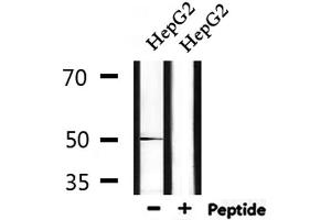 Western blot analysis of extracts from HepG2, using FOXA1 Antibody. (FOXA1 antibody  (C-Term))