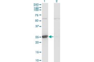 Western Blot analysis of TK1 expression in transfected 293T cell line by TK1 monoclonal antibody (M06), clone 3E2. (TK1 antibody  (AA 1-234))