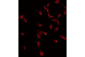 ABIN6275013 staining Hela by IF/ICC. (CKLF antibody)