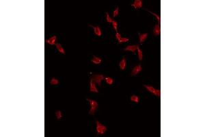 ABIN6275013 staining Hela by IF/ICC. (CKLF antibody)