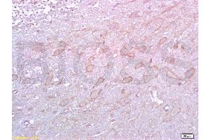 Immunohistochemistry (IHC) image for anti-5-Hydroxytryptamine (serotonin) Receptor 2A (HTR2A) (AA 65-160) antibody (ABIN737016)