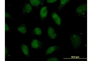 Immunofluorescence of monoclonal antibody to POU5F1 on HeLa cell. (OCT4 antibody  (AA 81-164))