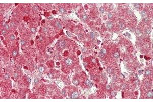 Detection of CPT1A in Human Liver Tissue using Polyclonal Antibody to Carnitine Palmitoyltransferase 1A, Liver (CPT1A) (CPT1A antibody  (AA 191-353))