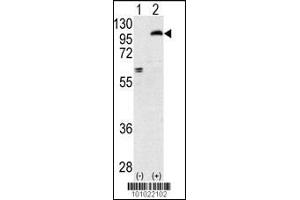 Western blot analysis of PRKCE using rabbit polyclonal PKC epsilon Antibody using 293 cell lysates (2 ug/lane) either nontransfected (Lane 1) or transiently transfected with the PRKCE gene (Lane 2). (PKC epsilon antibody  (N-Term))