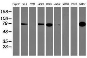 Image no. 1 for anti-phosphofructokinase, Platelet (PFKP) antibody (ABIN1500166) (PFKP antibody)