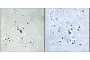Immunohistochemical analysis of paraffin-embedded human brain tissue using APLP2 (Phospho-Tyr755) antibody (left)or the same antibody preincubated with blocking peptide (right). (APLP2 antibody  (pTyr755))
