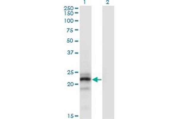 CGB antibody  (AA 70-165)