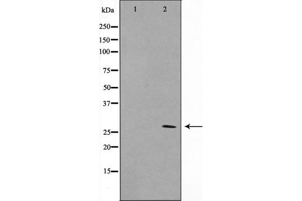 KDELR3 antibody  (Internal Region)