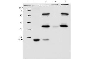 IP analysis of HPV-11 E7 protein. (Human Papilloma Virus 11 E7 (HPV-11 E7) (AA 36-70) antibody)