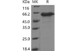Insulin-Like Growth Factor Binding Protein 7 (IGFBP7) protein (Fc Tag)