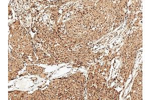 Immunohistochemistry analysis using Rabbit Anti-FUNDC1 Polyclonal Antibody (ABIN5066119). (FUNDC1 antibody  (N-Term))