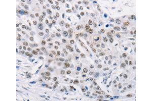 Immunohistochemistry (IHC) image for anti-Tripartite Motif Containing 63 (TRIM63) antibody (ABIN1875209) (TRIM63 antibody)