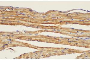 Immunohistochemistry of paraffin-embedded Mouse heart using CD146 Ployclonal Antibody at dilution of 1:50. (MCAM antibody)