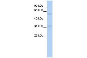 WB Suggested Anti-BTBD14B Antibody Titration:  0. (NAC1 antibody  (Middle Region))