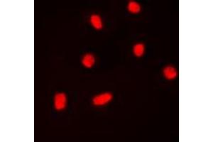 Immunofluorescent analysis of BAF53A staining in K562 cells. (BAF53A antibody  (Center))