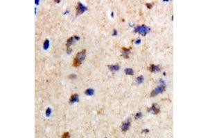 Immunohistochemical analysis of CCDC52 staining in rat brain formalin fixed paraffin embedded tissue section. (SPICE1 antibody)