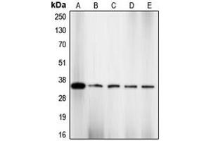 Western blot analysis of CDK2 (pT160) expression in NIH3T3 (A), HeLa (B), COLO205 (C), K562 (D), A2780 (E) whole cell lysates.