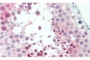 Detection of CDKN2D in Human Testis Tissue using Polyclonal Antibody to Cyclin Dependent Kinase Inhibitor 2D (CDKN2D) (CDKN2D antibody  (AA 1-166))