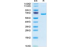 Mouse EphB3 on Tris-Bis PAGE under reduced condition. (EPH Receptor B3 Protein (EPHB3) (AA 30-554) (His tag))
