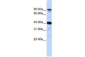 Western Blotting (WB) image for anti-Cysteinyl-tRNA Synthetase (CARS) antibody (ABIN2458484) (CARS antibody)