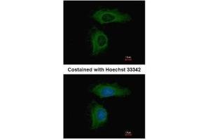 ICC/IF Image Immunofluorescence analysis of methanol-fixed HeLa, using PPP2R1A, antibody at 1:500 dilution. (PPP2R1A antibody  (Center))