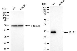 Western blotting analysis using Bcl-2 antibody (ABIN7797718). (Recombinant Bcl-2 antibody)
