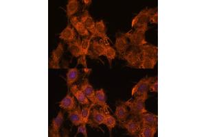 Immunofluorescence analysis of C6 cells using SNX15 antibody  at dilution of 1:100. (SNX15 antibody  (AA 1-342))