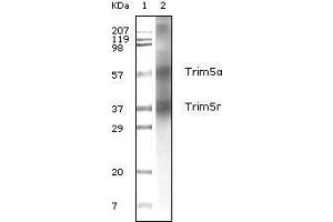 Western blot analysis using Trim5α mouse mAb against human breast carcinoma tissue lysate.