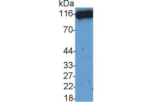 Detection of CD26 in HepG2 cell lysate using Polyclonal Antibody to Cluster Of Differentiation 26 (CD26) (DPP4 antibody  (AA 29-178))
