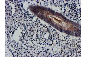 Immunohistochemical staining of paraffin-embedded Human endometrium tissue using anti-AKT1 mouse monoclonal antibody. (AKT1 antibody)